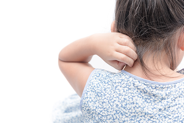 アトピー性皮膚炎