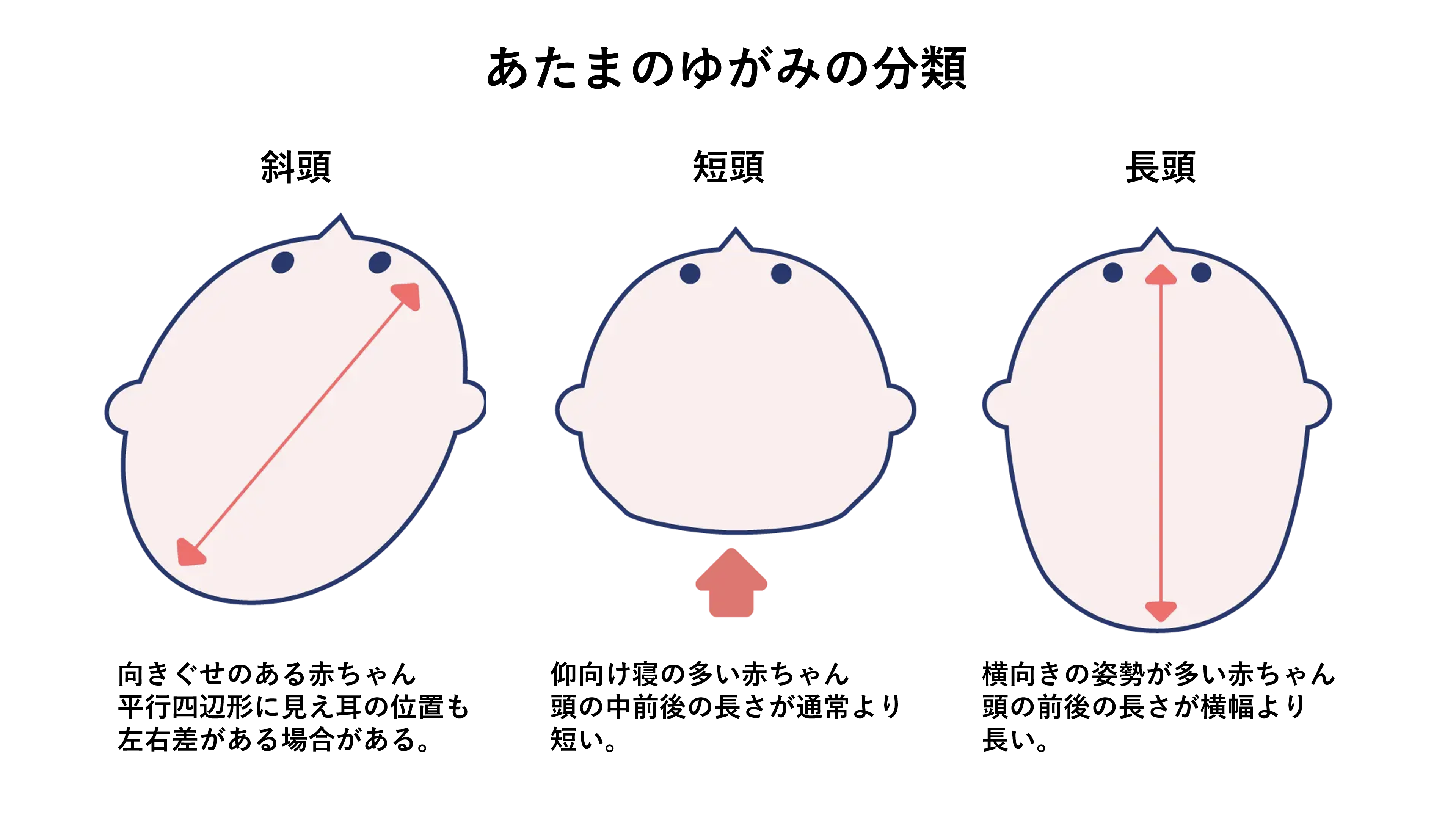 あたまのゆがみの分類